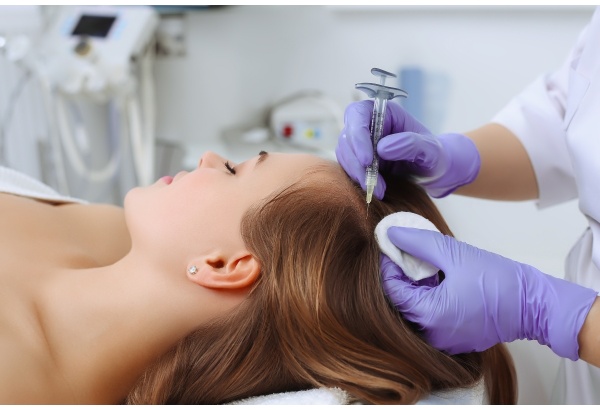 Mezoterapija plaukams su dr. Cyj Hair filler priemone  Vilniuje