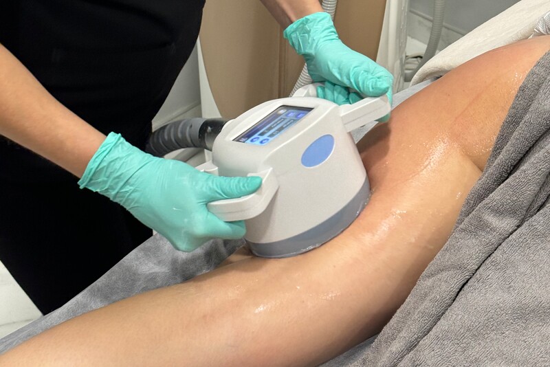 VelaShape III kūno formavimo ir anticeliulitinė procedūra Vilniuje