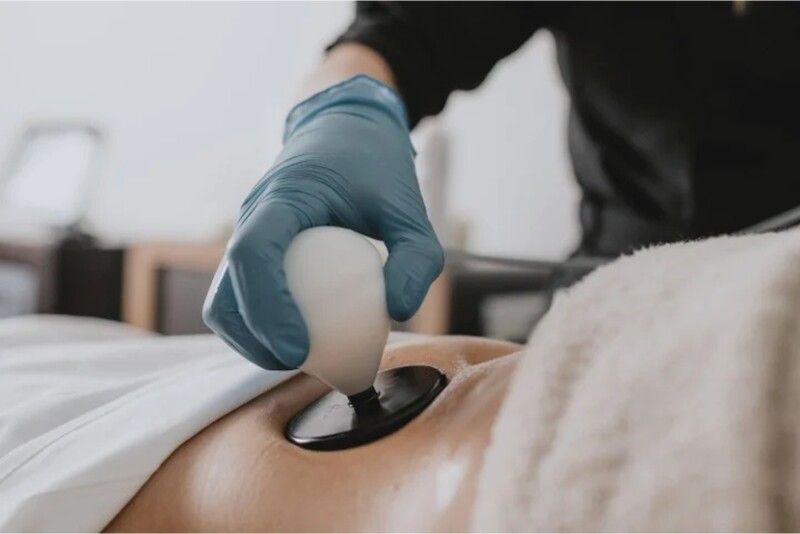 Liekninanti ir stangrinanti Q Skin Perfect procedūra pilvui Vilniuje